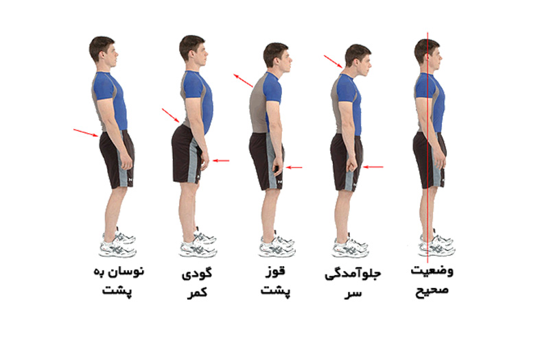 روش صحیح خوابیدن برای رفع گودی کمر